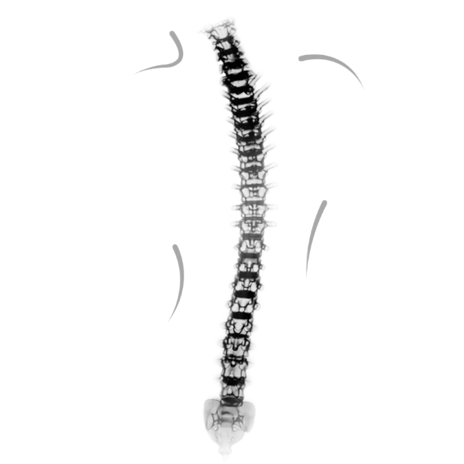 Rehabilitacja